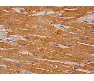 ARHGAP29 Antibody (H-2) - Immunohistochemistry - Image 286502 