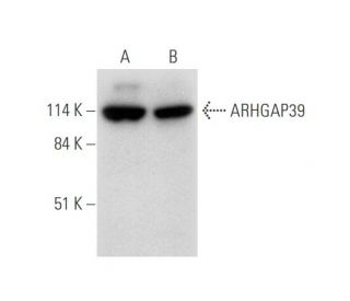 ARHGAP39 Antibody (H-2) - Western Blotting - Image 344589 