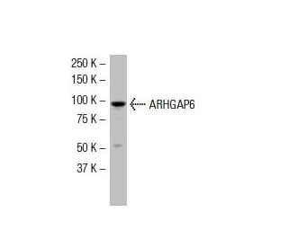 ARHGAP6 Antibody (D-5) - Western Blotting - Image 33588