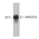 ARHGEF9 Antibody (3) - Western Blotting - Image 133239 