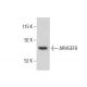 ARHGEF9 Antibody (3) - Western Blotting - Image 399329