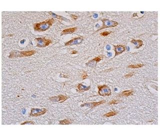 NUAK1/ARK5 Antibody (H-12) - Immunohistochemistry - Image 343935 