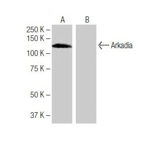 Arkadia Antibody (1-KK14) - Western Blotting - Image 64858
