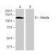 Arkadia Antibody (1-KK14) - Western Blotting - Image 64858