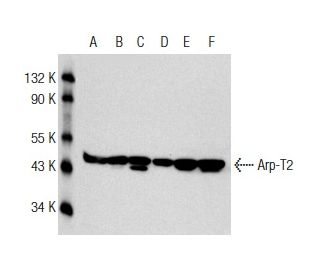Arp-T2 Antibody (NB82) - Western Blotting - Image 146751 