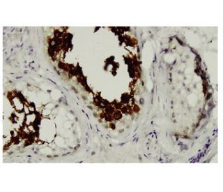 ART3 Antibody (125.1) - Immunohistochemistry - Image 35954 