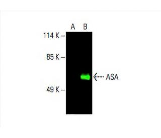 ASA Antibody (H-5) - Western Blotting - Image 394209 