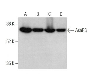 AsnRS Antibody (G-8) - Western Blotting - Image 375584 