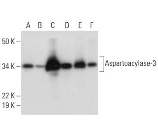 Aspartoacylase-3 Antibody (A-5) - Western Blotting - Image 299176