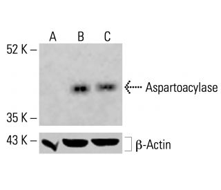 Aspartoacylase Antibody (F-1) - Western Blotting - Image 414342 