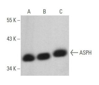 ASPH Antibody (F-7) - Western Blotting - Image 359072 