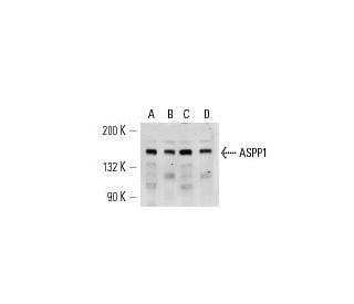 ASPP1 Antibody (LX011) - Western Blotting - Image 14601SAM Transcription Activation: SAM system utilizing dCas9-VP64, MS2-P65-HSF1, and sgRNA for precise gene transcription activation. 