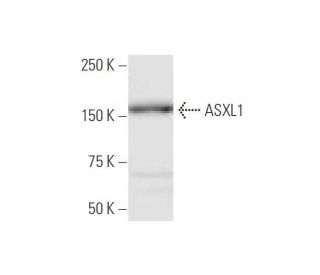 ASXL1 Antibody (6E2) - Western Blotting - Image 347640 