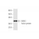 ASXL1 Antibody (6E2) - Western Blotting - Image 350349