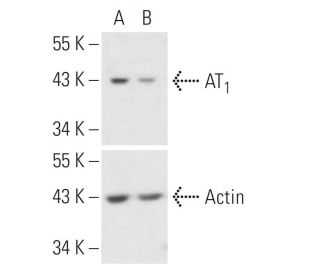 AT<sub>1</sub> siRNA (h): sc-29750. Western blot analysis of AT<sub>1</sub> expression in non-transfected control (A) and 