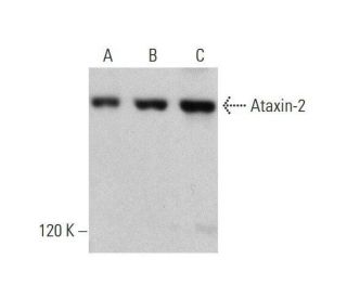 Ataxin-2 Antibody (A-6) - Western Blotting - Image 352625