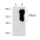 TRIM29 Antibody (B-11) - Western Blotting - Image 148720