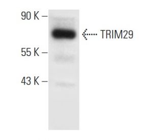 TRIM29 Antibody (B-11) - Western Blotting - Image 301302 