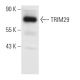 TRIM29 Antibody (B-11) - Western Blotting - Image 301302 