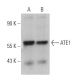 ATE1 Antibody (E-4) - Western Blotting - Image 367041 