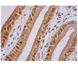 ATF-1/ATF1 Antibody (H-3) - Immunohistochemistry - Image 351540 