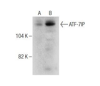 ATF-7IP Antibody (B-7) - Western Blotting - Image 283502 