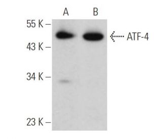 ATF4 Antibody (B-3) - Western Blotting - Image 360496The Double Nickase Plasmid features a U6 promoter for sgRNA expression, a 20 nt targeting sequence, and a gRNA scaffold to guide Cas9n. It includes a CBh promoter for Cas9n (D10A) and puromycin resistance, GFP for transfection verification, and nuclear localization signals (NLS). The 2A peptide allows co-expression of Cas9n and Puro from a single promoter, enabling precise genome editing with reduced off-target effects.