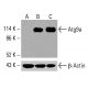 Atg9a 抗体 (F-3): sc-518179。未经处理(A)及经化学处理(B、C)的HCT-116全细胞裂解液中Atg9a表达的Western blot分析。β-肌动蛋白(C4):sc-47778用作内参。所用检测试剂:m-IgG Fc BP-HRP:sc-525409。 Atg9a Antibody (F-3) - Western Blotting - Image 416484
