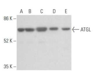 ATGL Antibody (F-7) - Western Blotting - Image 354973
