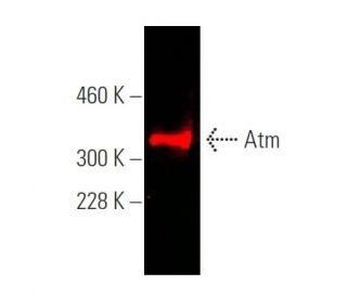 Atm Antibody (G-12) - Western Blotting - Image 375244