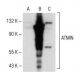 ATMIN Antibody (B-1) - Western Blotting - Image 150563