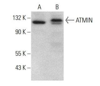 ATMIN Antibody (B-1) - Western Blotting - Image 379088 