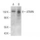 ATMIN Antibody (B-1) - Western Blotting - Image 379081 
