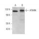 ATMIN Antibody (B-1) - Western Blotting - Image 379088 