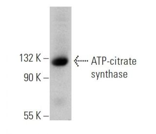 ATP-citrate synthase Antibody (5F8D11) - Western Blotting - Image 368289 
