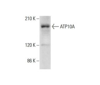 ATP10A Antibody (G-9) - Western Blotting - Image 325137 