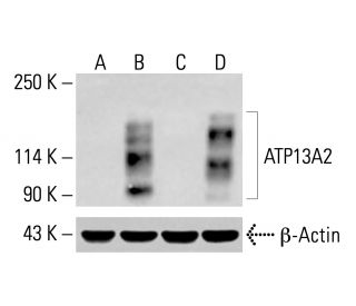 ATP13A2 Antibody (4B7) - Western Blotting - Image 414180 
