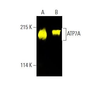 ATP7A Antibody (D-9) - Western Blotting - Image 397472Each CRISPR/Cas9 Knockout (KO) Plasmid product consists of a pool of 3 plasmids designed to ensure identification and cleavage of a specific gene for maximum knockout efficiency. Each plasmid encodes a unique 20 nt sequence derived from the GeCKO (v2) library. 