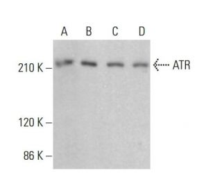ATR Antibody (C-1) - Western Blotting - Image 380520Each CRISPR/Cas9 Knockout (KO) Plasmid product consists of a pool of 3 plasmids designed to ensure identification and cleavage of a specific gene for maximum knockout efficiency. Each plasmid encodes a unique 20 nt sequence derived from the GeCKO (v2) library.