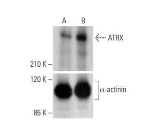 ATRX Antibody (D-5) - Western Blotting - Image 332184 