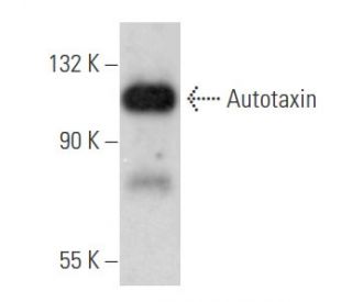 Autotaxin Antibody (E-12) - Western Blotting - Image 355797Each CRISPR/Cas9 Knockout (KO) Plasmid product consists of a pool of 3 plasmids designed to ensure identification and cleavage of a specific gene for maximum knockout efficiency. Each plasmid encodes a unique 20 nt sequence derived from the GeCKO (v2) library.