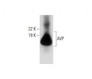 AVP Antibody (E-8) - Western Blotting - Image 289626 