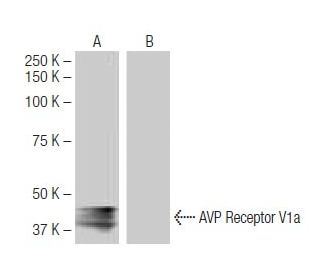 AVP Receptor V1a Antibody (7G8) - Western Blotting - Image 64864