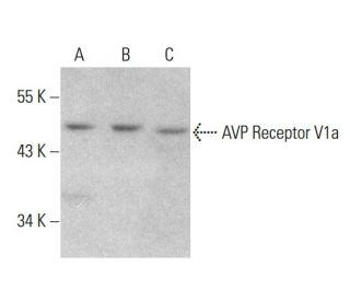 AVP Receptor V1a Antibody (721CT25.2.1) - Western Blotting - Image 376892Each CRISPR/Cas9 Knockout (KO) Plasmid product consists of a pool of 3 plasmids designed to ensure identification and cleavage of a specific gene for maximum knockout efficiency. Each plasmid encodes a unique 20 nt sequence derived from the GeCKO (v2) library.