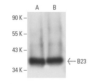 B23/Nucleophosmin Antibody (FC-8791) - Western Blotting - Image 9894 