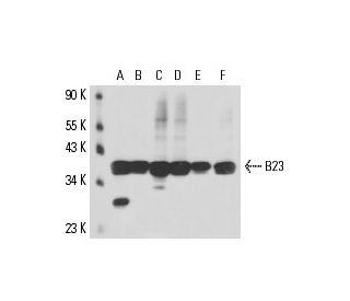 B23/Nucleophosmin Antibody (NA24) - Western Blotting - Image 16152 