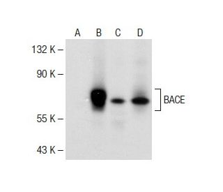 BACE Antibody (61-3E7) - Western Blotting - Image 141596 