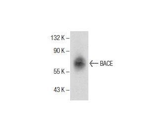 BACE Antibody (H-10) - Western Blotting - Image 286064Each CRISPR/Cas9 Knockout (KO) Plasmid product consists of a pool of 3 plasmids designed to ensure identification and cleavage of a specific gene for maximum knockout efficiency. Each plasmid encodes a unique 20 nt sequence derived from the GeCKO (v2) library.