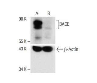 BACE HDR Plasmid (h): sc-401500-HDR. Western blot analysis of BACE... 