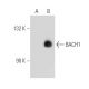 BACH1 Antibody (L-25) - Western Blotting - Image 49595